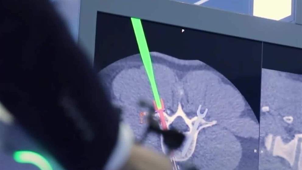 الذكاء الاصطناعي يرسم ملامح المستقبل الصحي في الامارات