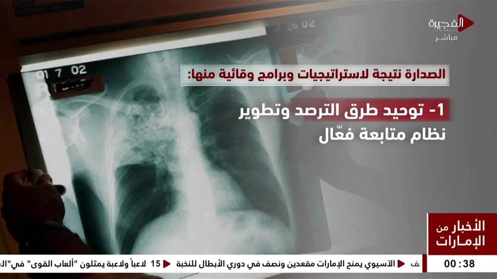 وزارة الصحة  الإمارات في صدارة الدول ذات المعدلات المنخفضة بمرض السل